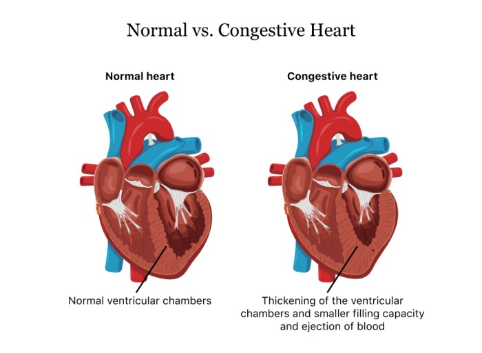 What is ccf in medical terms