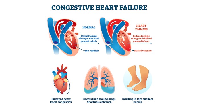 What is ccf in medical terms