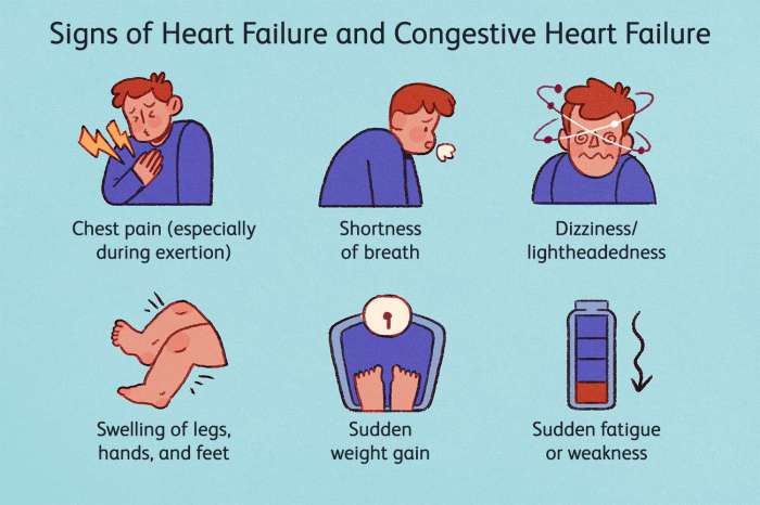 Failure heart congestive cardiac